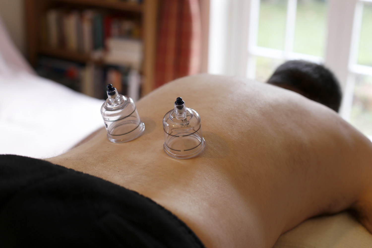 cupping massage cheltenham gloucestershire annie white